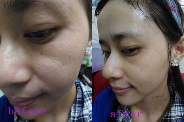 妍霓絲極淨透碳深層喚白黑凍膜