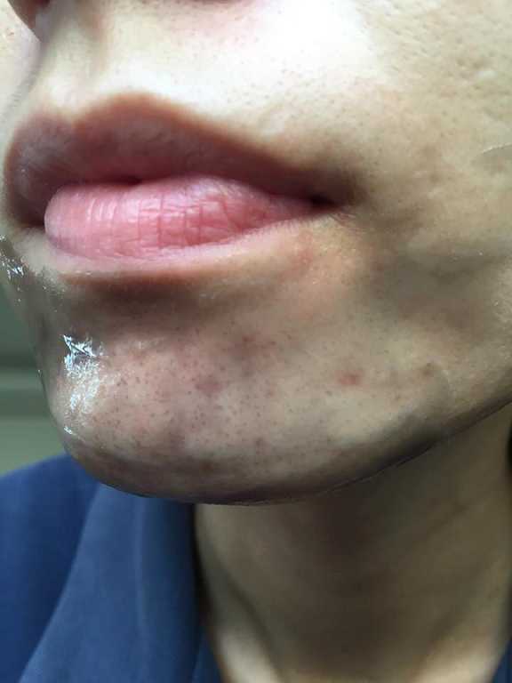 妍霓絲極淨透碳深層喚白黑凍膜