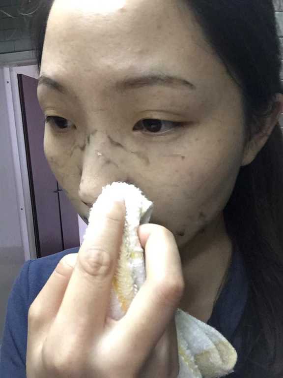 妍霓絲極淨透碳深層喚白黑凍膜