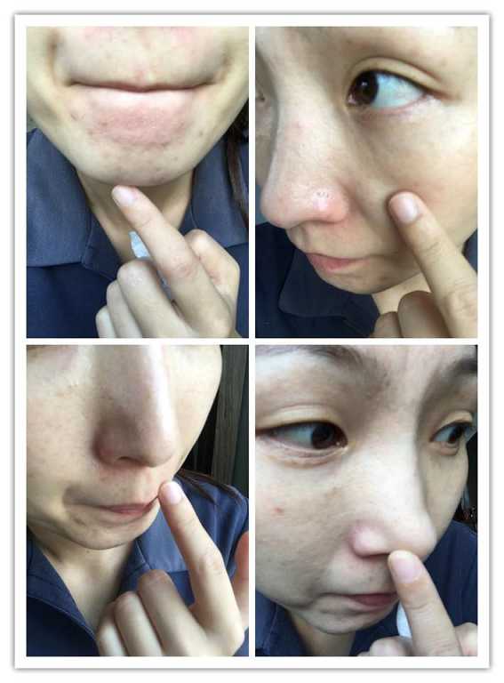 妍霓絲極淨透碳深層喚白黑凍膜