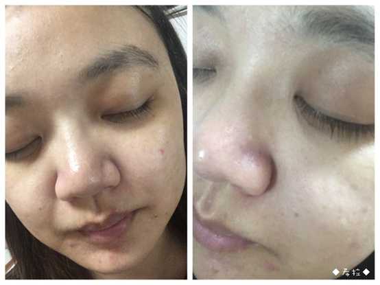 妍霓絲極淨透碳深層喚白黑凍膜