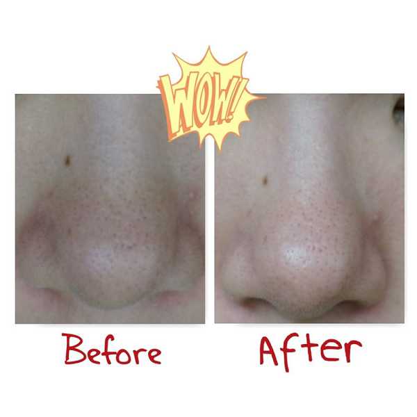 妍霓絲極淨透碳深層喚白黑凍膜