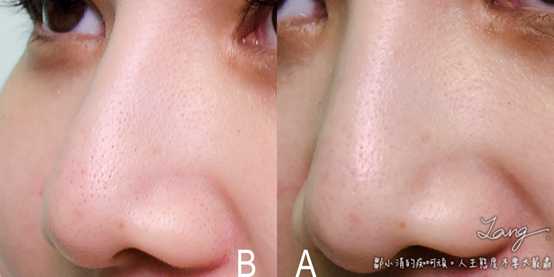 妍霓絲極淨透碳深層喚白黑凍膜