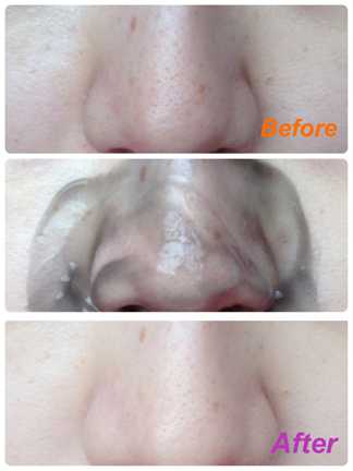 妍霓絲極淨透碳深層喚白黑凍膜