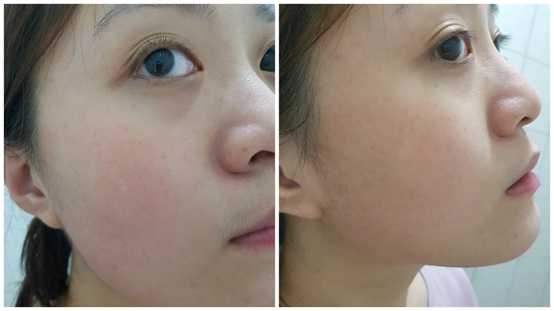 妍霓絲極淨透碳深層喚白黑凍膜