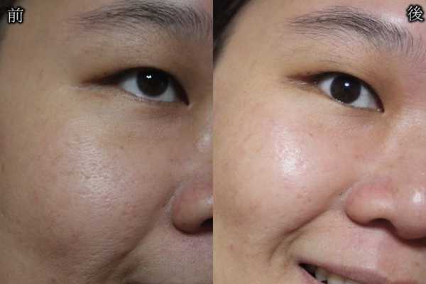 妍霓絲極淨透碳深層喚白黑凍膜