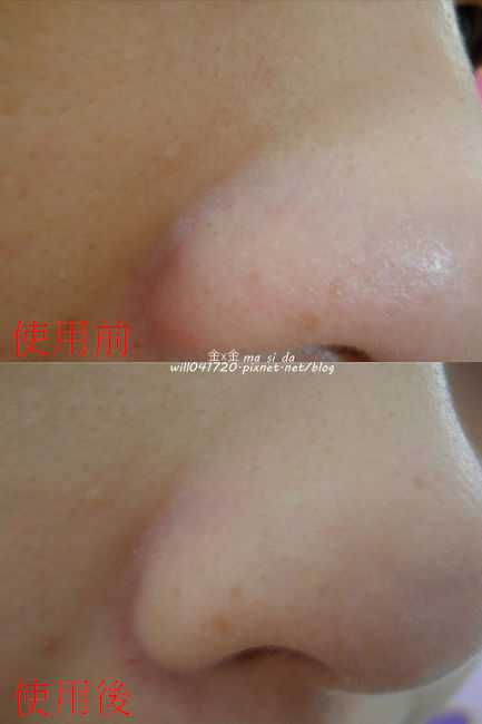 妍霓絲極淨透碳深層喚白黑凍膜