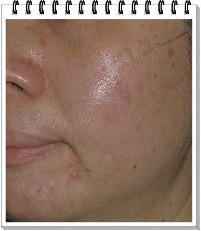  CENLIS聖黎詩淨白無瑕精華液