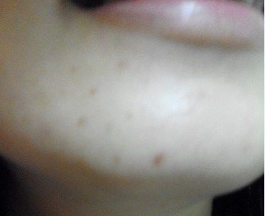  CENLIS聖黎詩淨白無瑕精華液