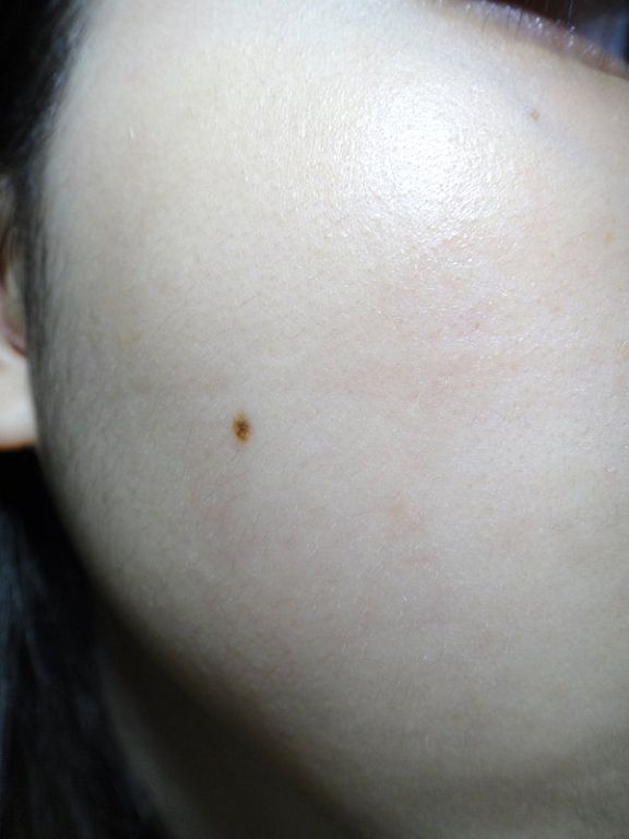 女人 知己 試用 大隊 CENLIS 聖黎詩 淨白 無瑕 精華液 醫美級 保養 chialo