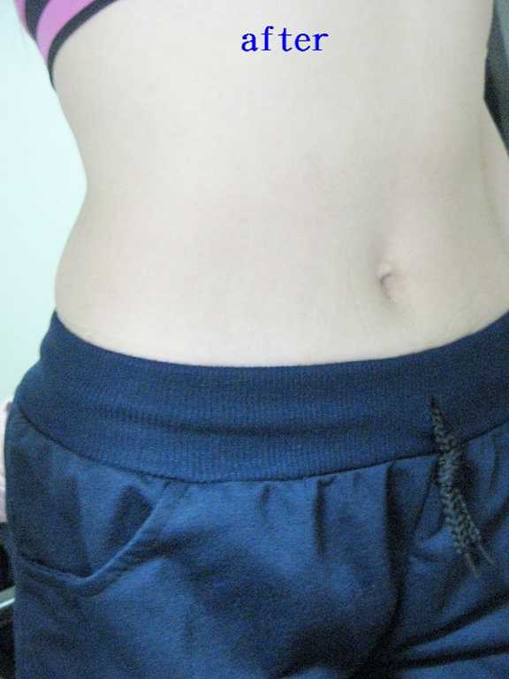 BioOne碧而優益生菌