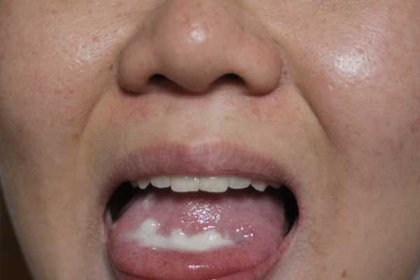 BioOne碧而優益生菌