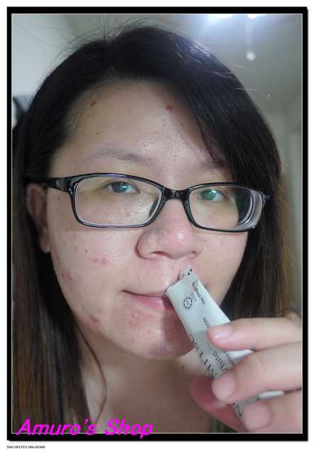 Kinohimitsu擊黑素