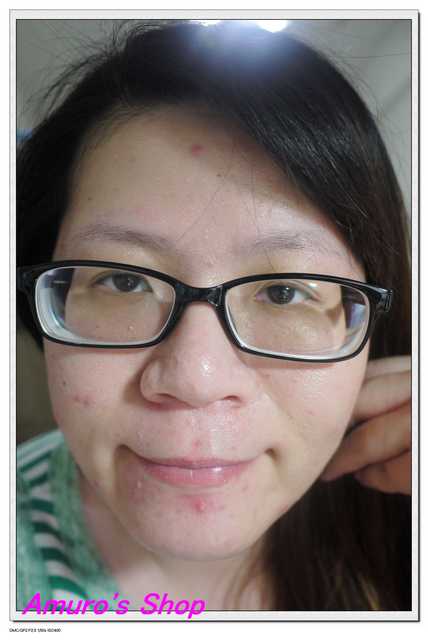 Kinohimitsu擊黑素