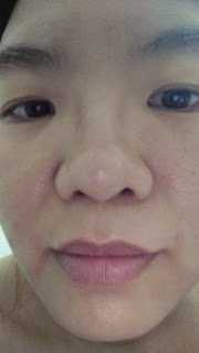 Kinohimitsu擊黑素