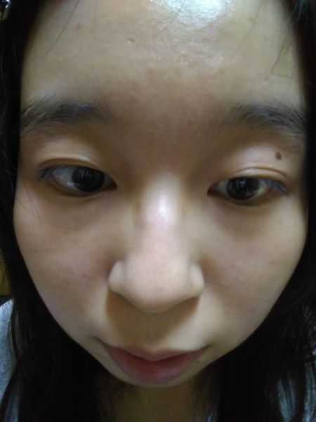 Kinohimitsu擊黑素