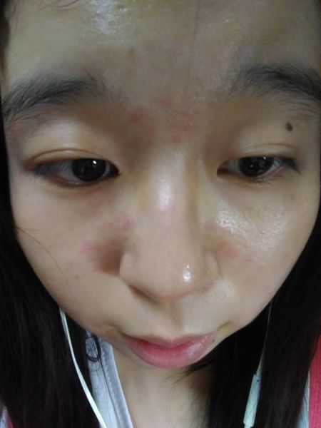 Kinohimitsu擊黑素