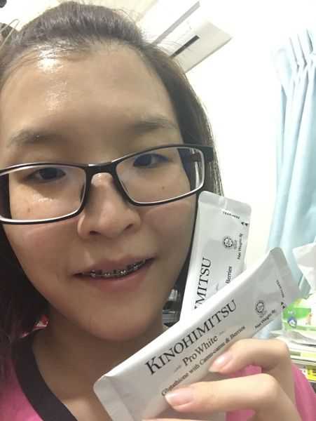 Kinohimitsu擊黑素