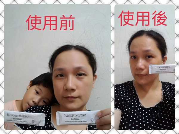 Kinohimitsu擊黑素