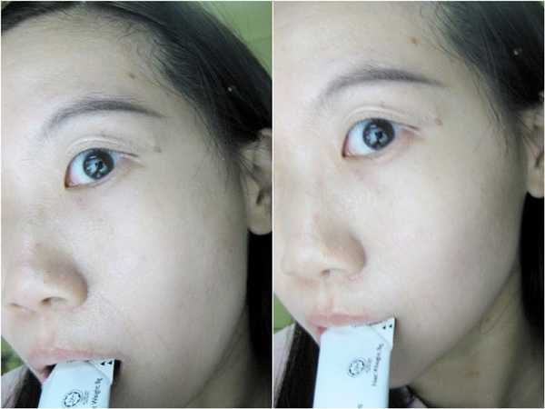 Kinohimitsu擊黑素