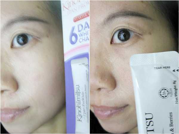 Kinohimitsu擊黑素