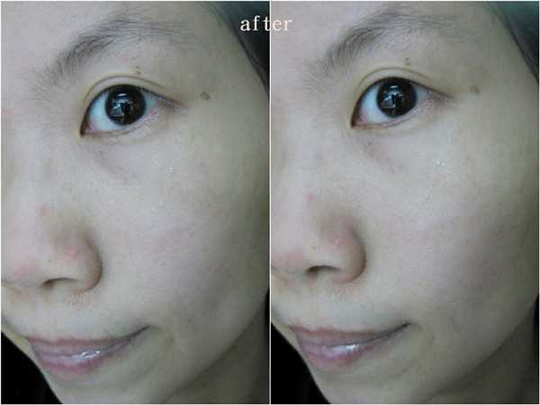 Kinohimitsu擊黑素