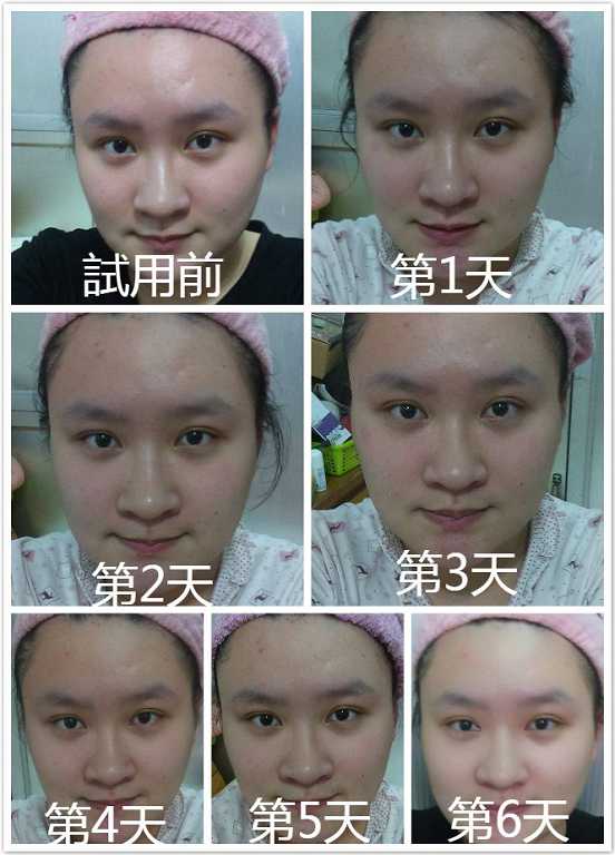 Kinohimitsu擊黑素