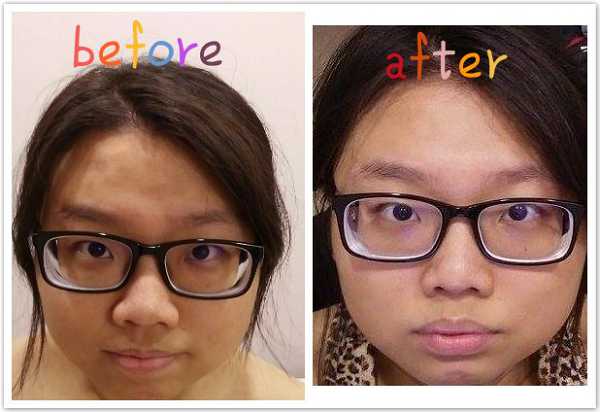 Kinohimitsu擊黑素