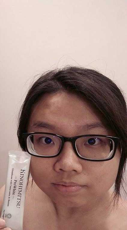 Kinohimitsu擊黑素