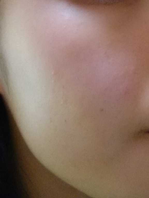 Kinohimitsu擊黑素