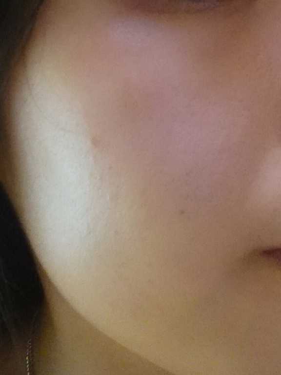 Kinohimitsu擊黑素