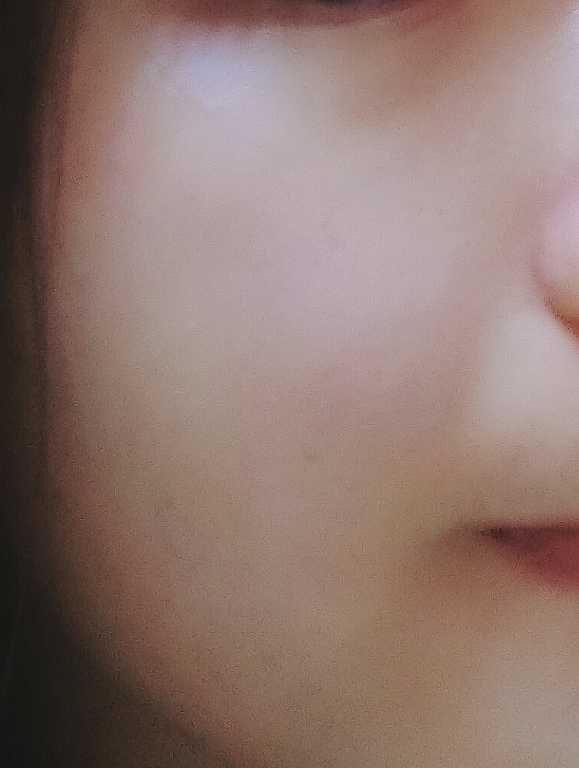 Kinohimitsu擊黑素