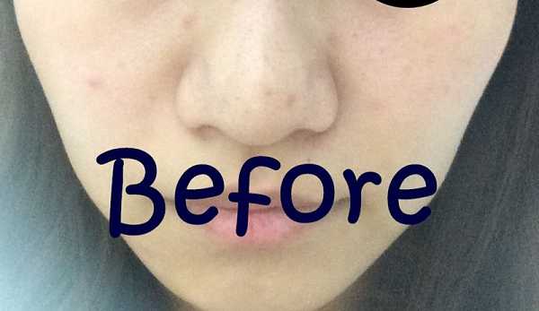 Kinohimitsu擊黑素