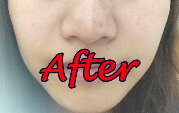 Kinohimitsu擊黑素