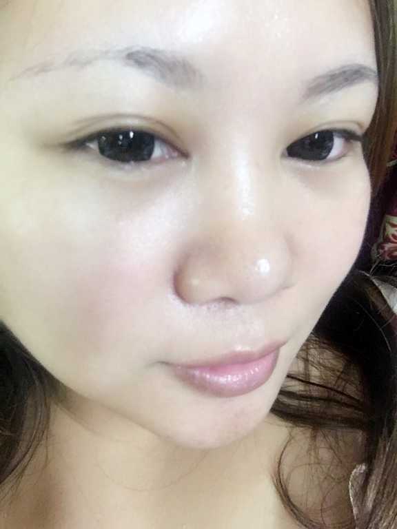 Kinohimitsu擊黑素