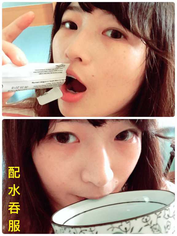 Kinohimitsu擊黑素