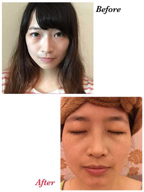 Kinohimitsu擊黑素