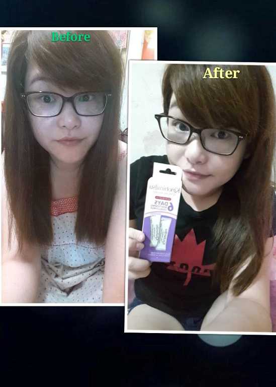 Kinohimitsu擊黑素