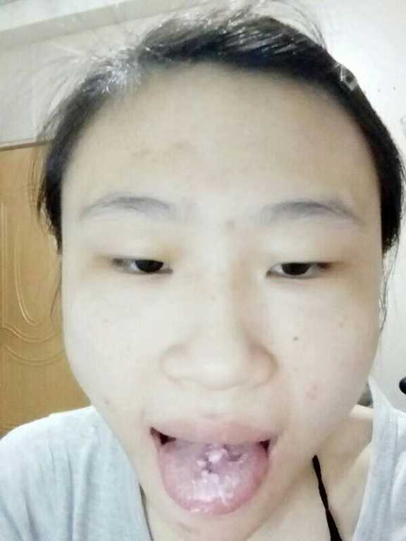 Kinohimitsu擊黑素