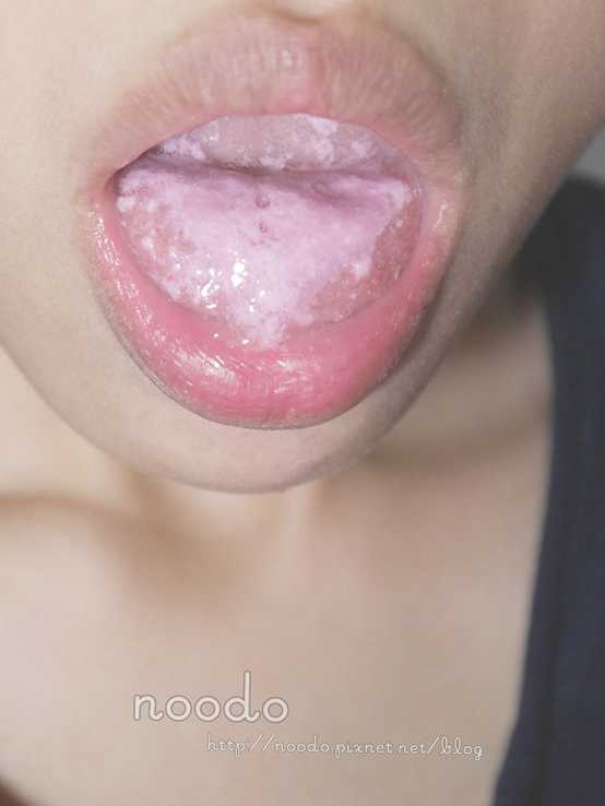 Kinohimitsu擊黑素