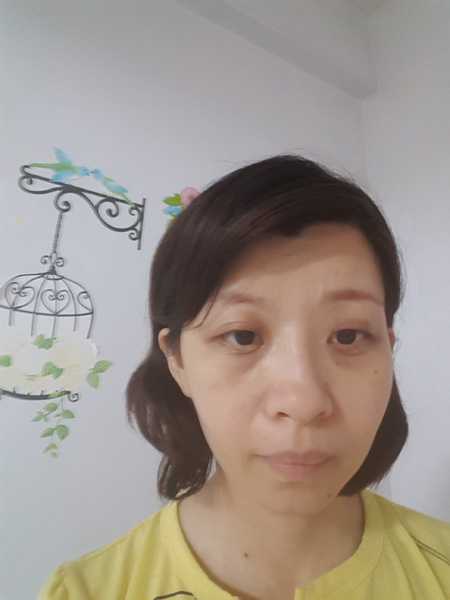 Kinohimitsu擊黑素