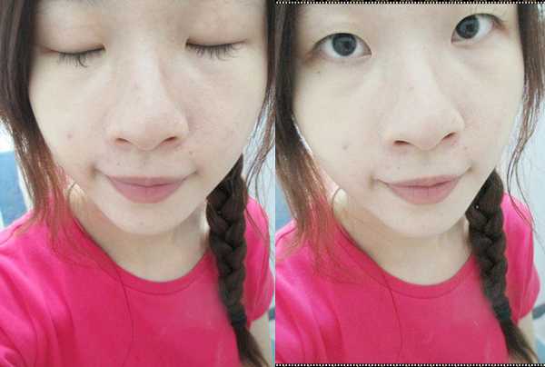 Kinohimitsu擊黑素