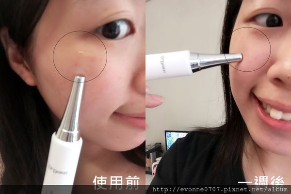 朵璽XIN NI SUNG激光瞬效美白精華