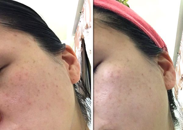 朵璽XIN NI SUNG激光瞬效美白精華