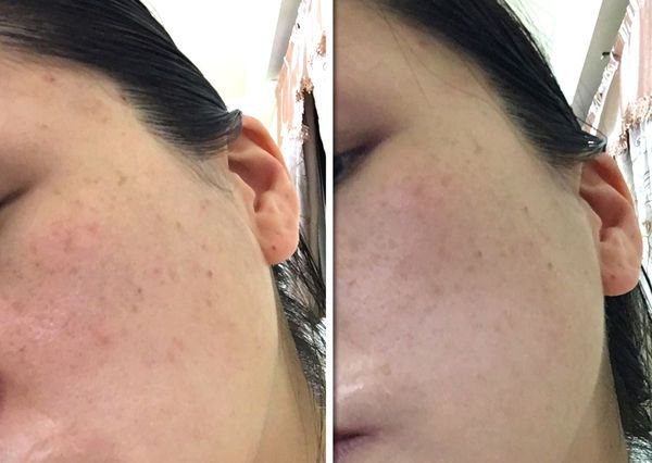 朵璽XIN NI SUNG激光瞬效美白精華