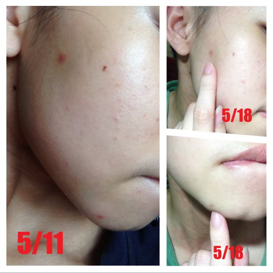 朵璽XIN NI SUNG激光瞬效美白精華