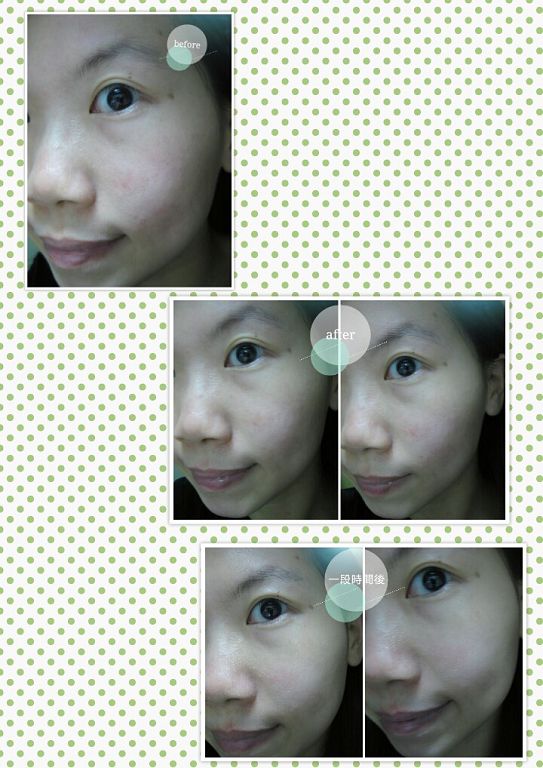 朵璽XIN NI SUNG激光瞬效美白精華