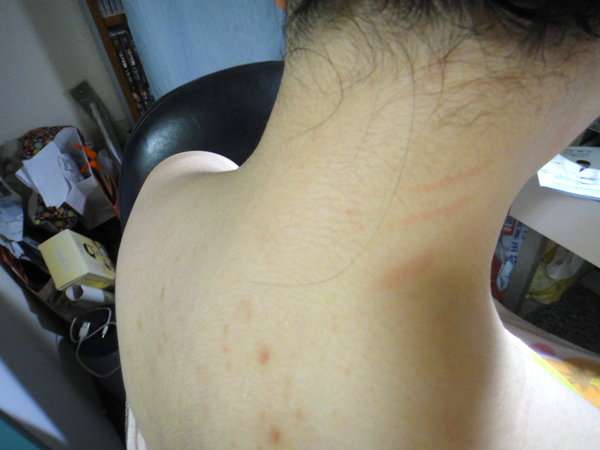 女人 知己 試用 大隊 chialo birthday 多醣體 纖維 體膜 王祚軒 醫生 推薦