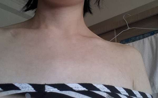 birthday多醣體纖維體膜