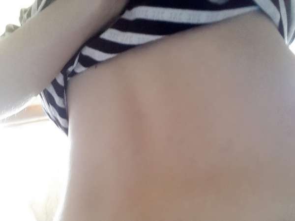 birthday多醣體纖維體膜